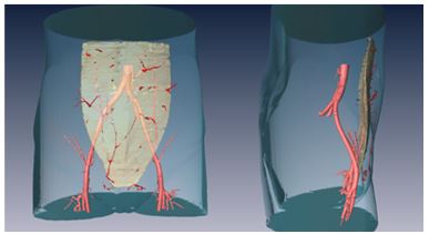 1581924831917.jpg 栾杰 乳房再造的微创化、精细化与个性化 4.jpg