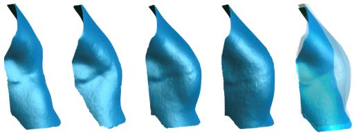 1581924852449.jpg 栾杰 乳房再造的微创化、精细化与个性化 5.jpg