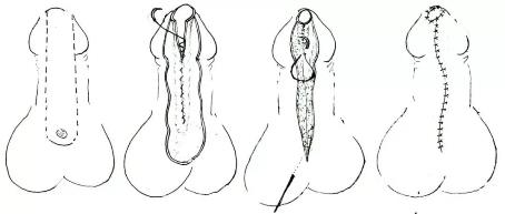 1584946772213.jpg 健康报 男性无法站着排尿?2.jpg