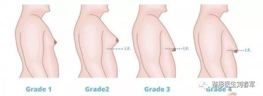 1585039694425.jpg 微信 看海王杰森·莫玛,说说男子汉胸部那些事儿?3.jpg