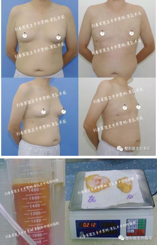 1585039744308.jpg 微信 看海王杰森·莫玛,说说男子汉胸部那些事儿?5.jpg