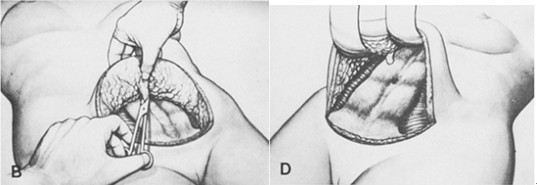 李发成  产后肚皮松10.jpg