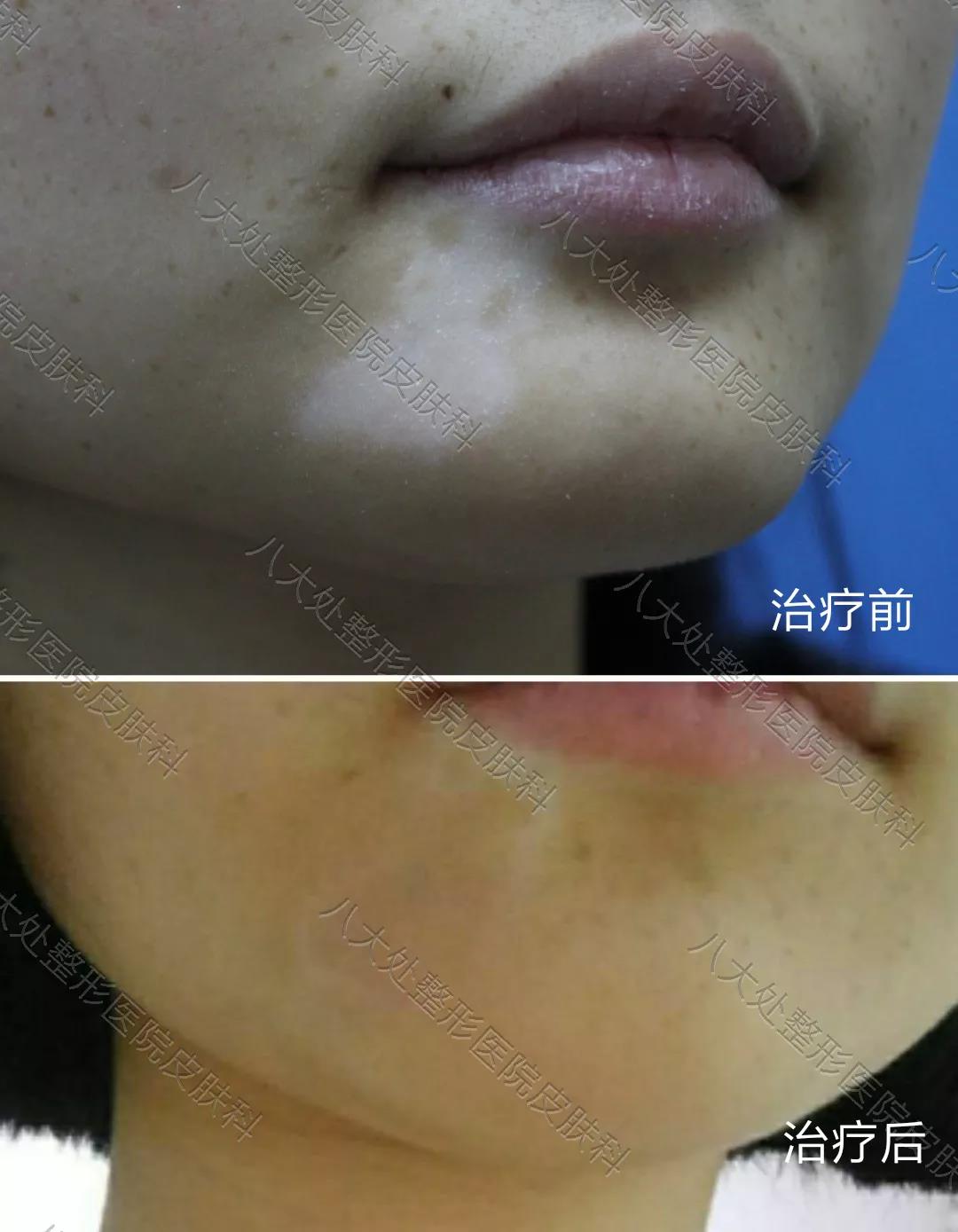 1592896339361.jpg 1592896339361.jpg