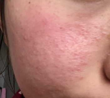 1594206538673.png image.png