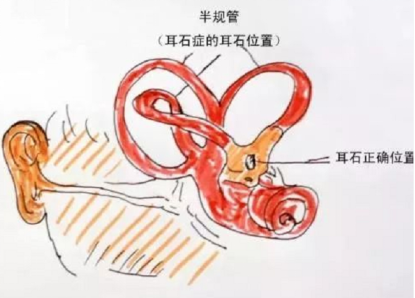 1718245203958.png 640.png